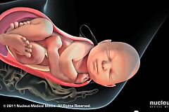 Video Melahirkan Normal